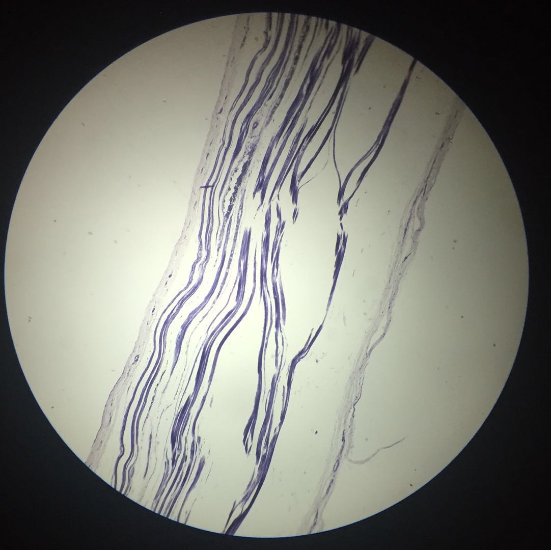  Human skeletal muscle- 40x magnification