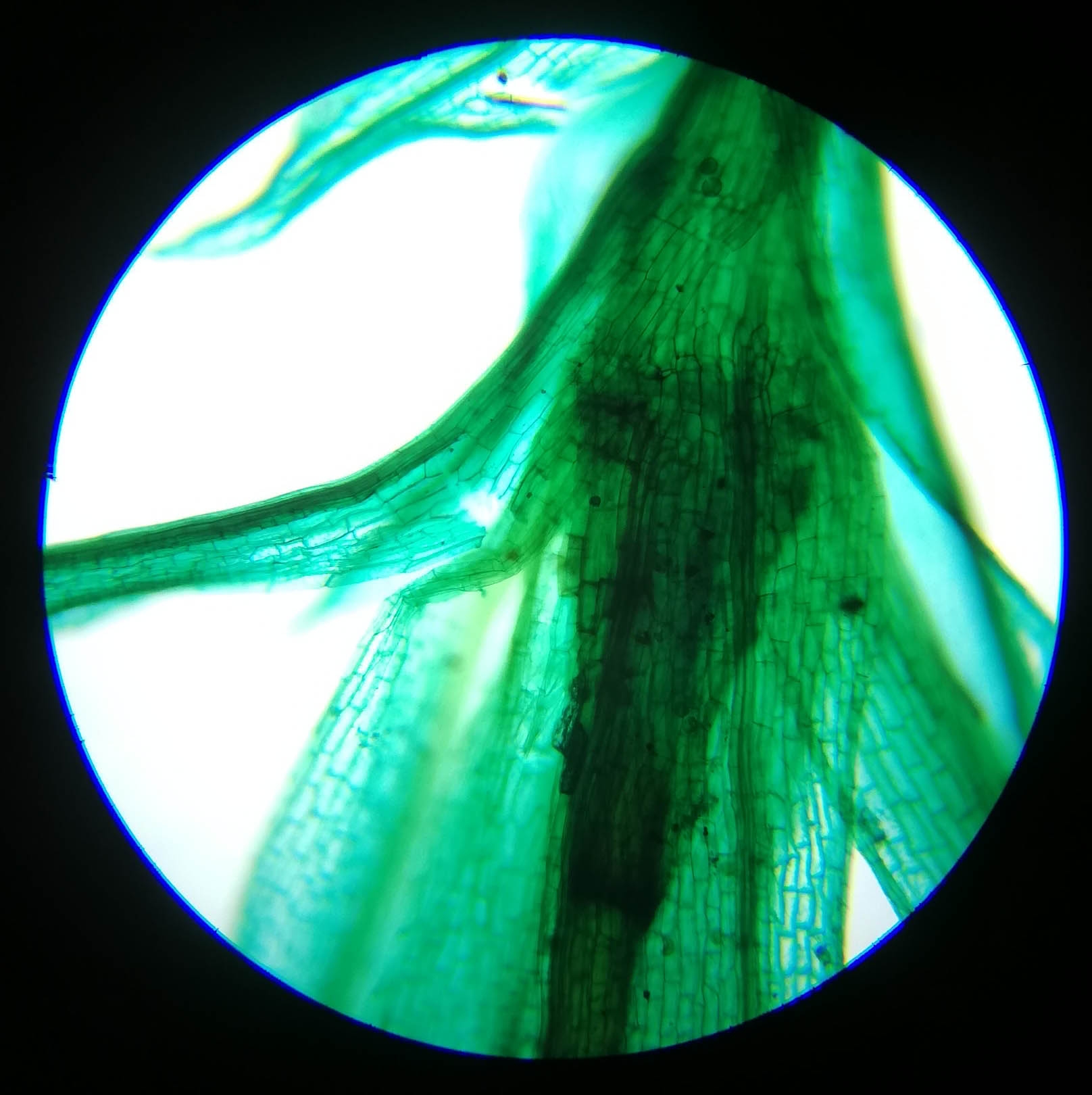 Fern Young Sporophyte W.M #1 - 100x magnification