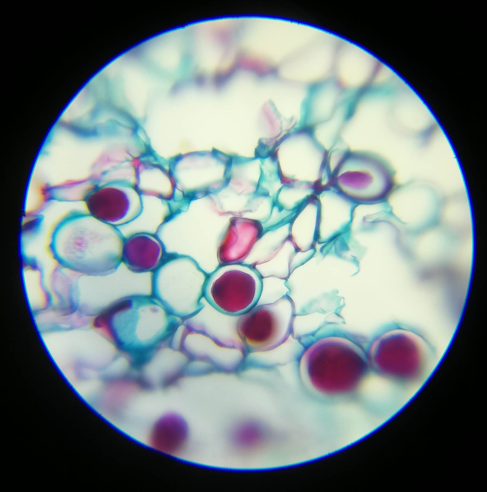 Suber Cell Sec - 400x magnification